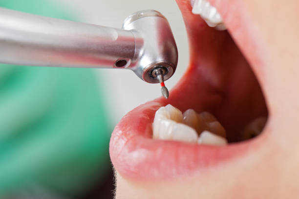 Best Holiday Emergency Dentist in St Bernard, OH